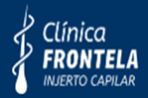 Clínica Frontela Micropigmentación capilar